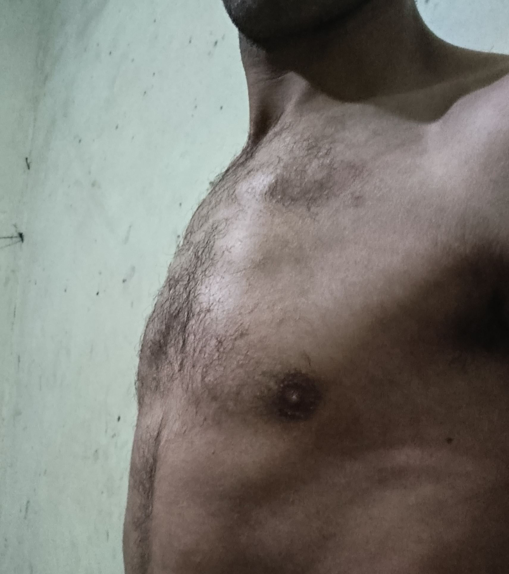 Help Abdelkabir Get the Medical Treatment He Needs
