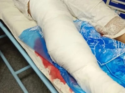 Help Pramila Heal: Fundraising for Surgery