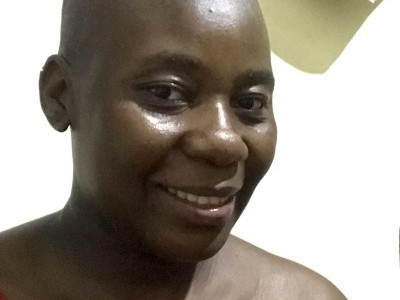 Suffering from hair loss need help to buy wigs and hair products